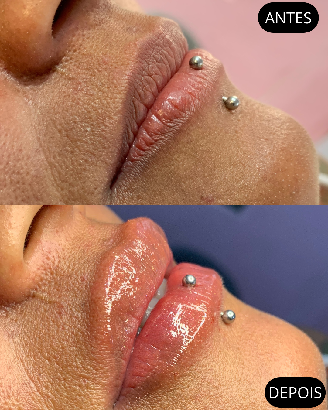 Beige Minimalist Beauty Before After Collage Instagram Post.png (1)