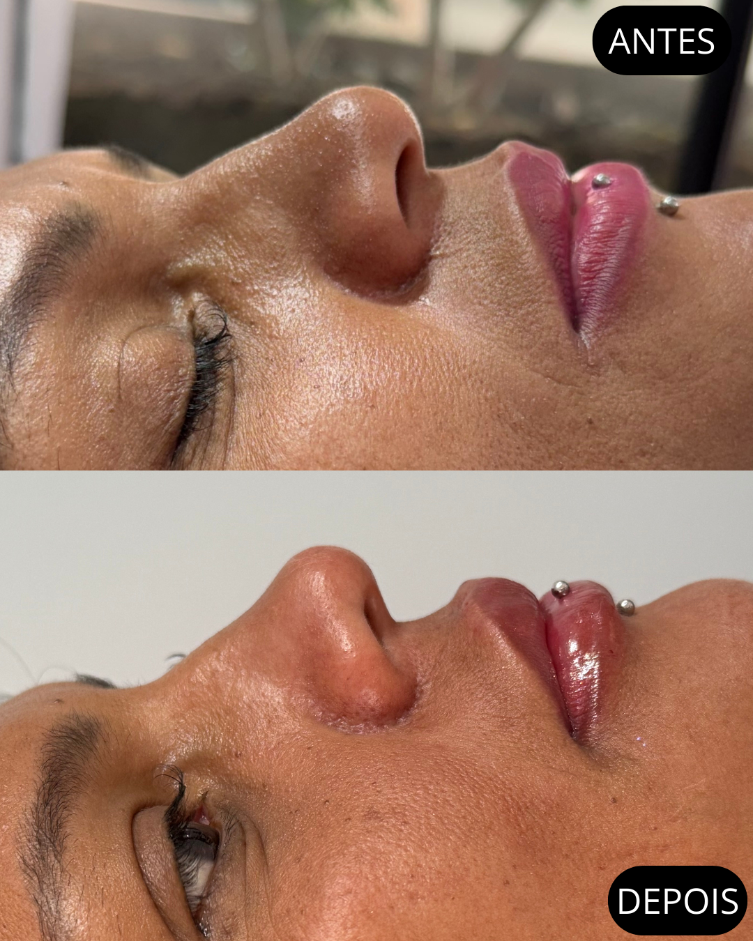 Beige Minimalist Beauty Before After Collage Instagram Post.png (2)