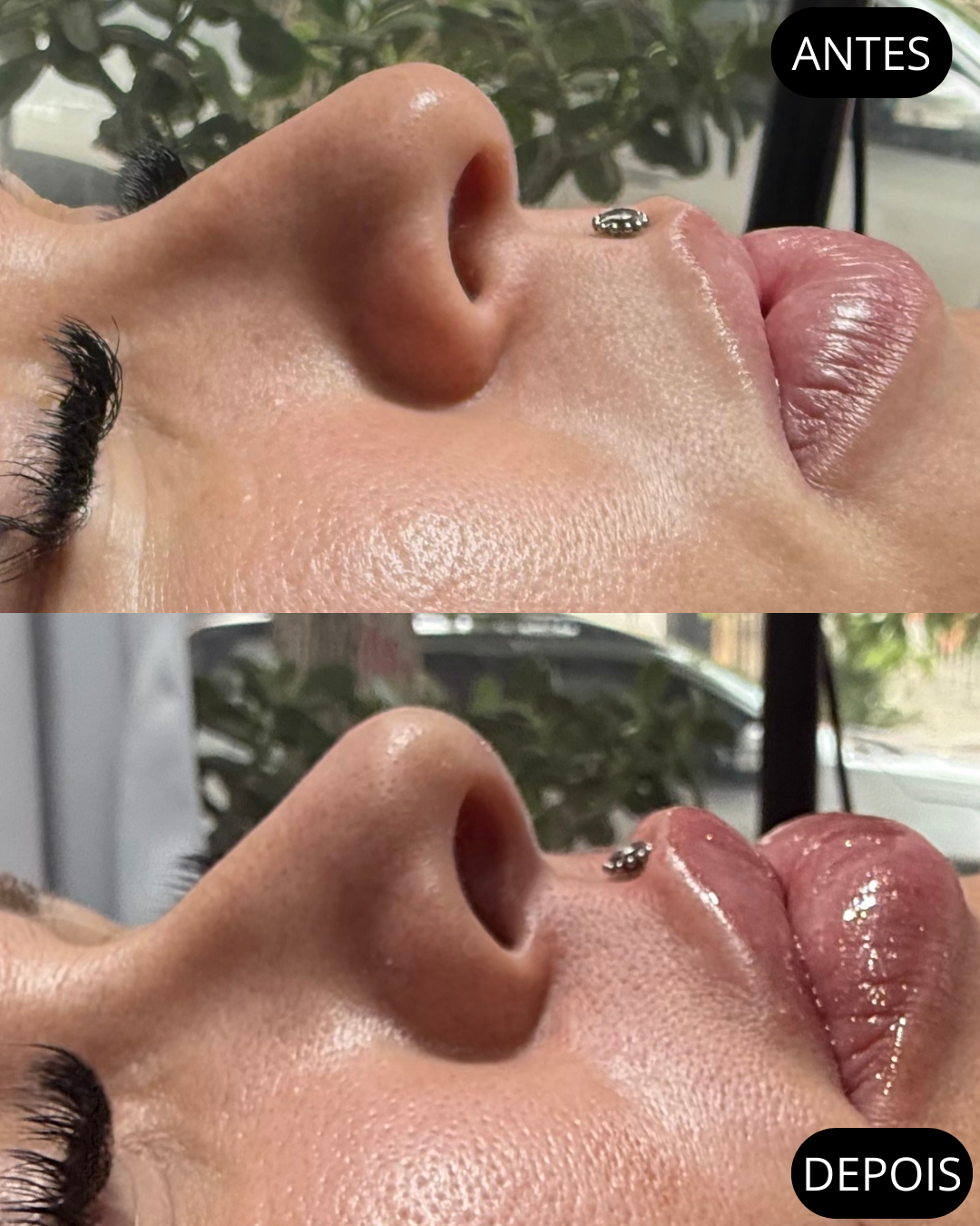 Beige Minimalist Beauty Before After Collage Instagram Post.png